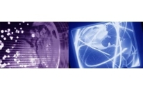 LED-TV: Unity Opto und Formosa Epitaxy senken 2010er Prognose