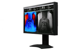 NEC präsentiert neuen 30-Zoll-Farbmonitor für die Primärdiagnostik