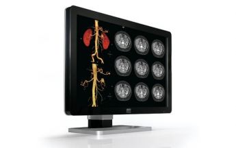 Diagnose-Display von Barco mit 4-Megapixel-Auflösung