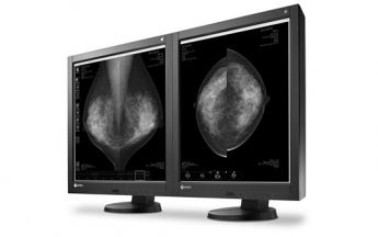 RadiForce GX540: Eizo bringt Monitor für digitale Mammographie