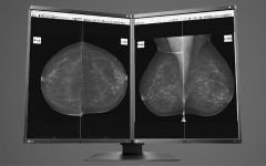 EIZO RadiForce GX560-MD