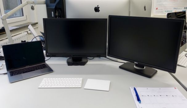Die Ausgangslage: Zwei etwas ungleiche 23-/24-Zoll-Monitore sind via USB-C-Hub an ein MacBook Pro angeschlossen
