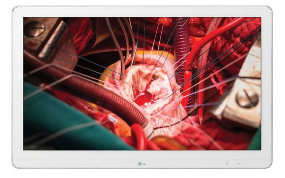 LG 27HK510S-W (Bild: LG)