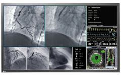 EIZO RadiForce LL580W (Bild: EIZO)