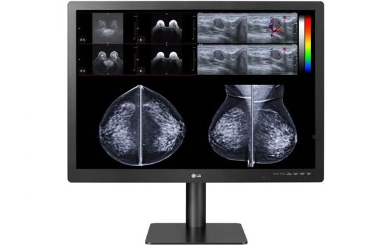 LG 31HN713D-BA (Bild: LG)