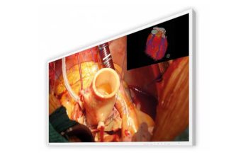 EIZO EX4342: Neues 4K-IPS-Display für die Chirurgie EIZO CuratOR EX4342 (Bild: EIZO)