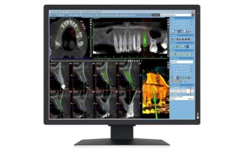 EIZO RadiForce MX217-HB (Bild: EIZO)