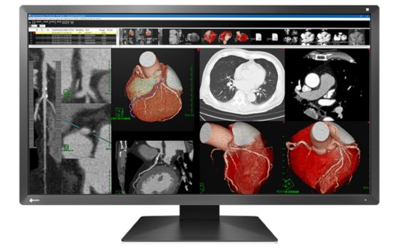 EIZO RadiForce MX317W (Bild: EIZO)