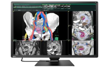 EIZO RadiForce RX670 (Bild: EIZO)
