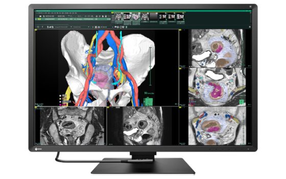 EIZO RadiForce RX670 (Bild: EIZO)