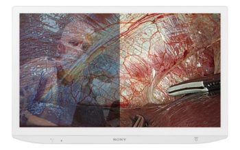 Sony: Medizin-Display mit 4K, Mini-LED und HDR 1000 Sony LMD-32M1MD (Bild: Sony)